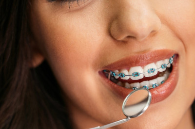 Do Braces Hurt? Understanding Discomfort and How to Manage It